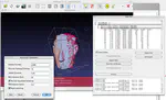 MeshLab: an Open-Source Mesh Processing Tool